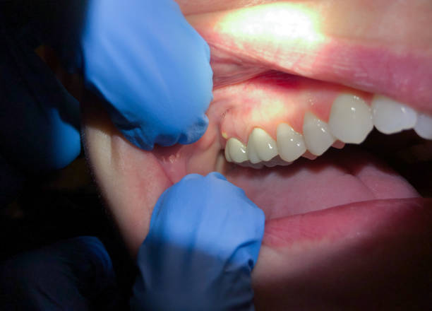 Best Pediatric Emergency Dentist in Gilmer, TX