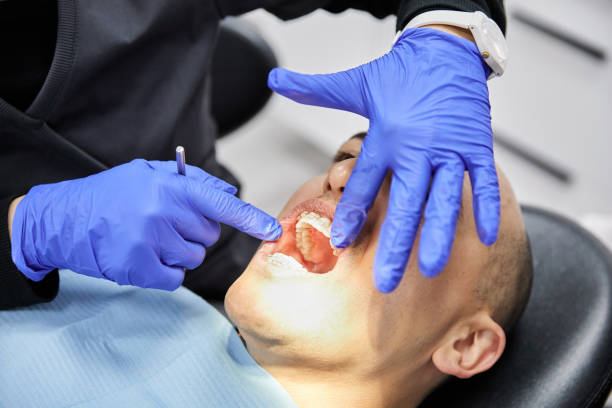 Best Emergency Tooth Extraction in Gilmer, TX