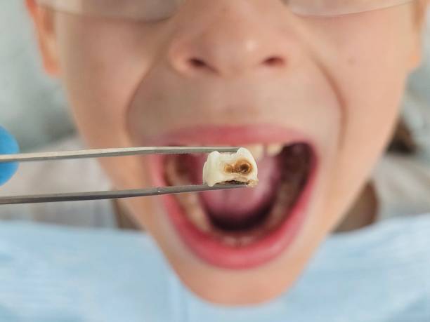 Best Pediatric Emergency Dentist in Gilmer, TX